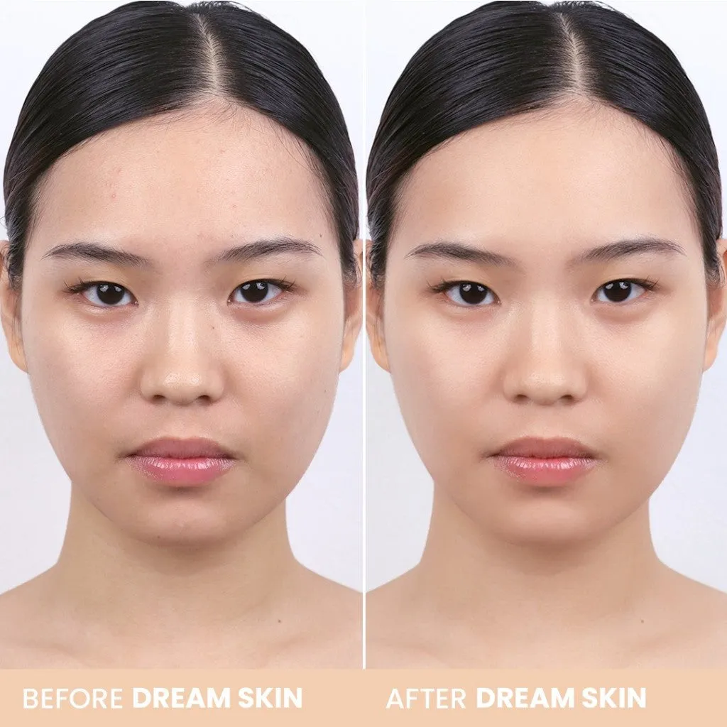 Dream Skin